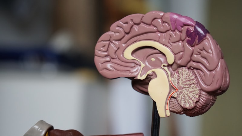 Alzheimer huzurevi seçimi